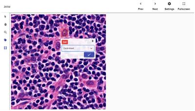 Detection of centroblast cells in H&E stained whole slide image based on object detection